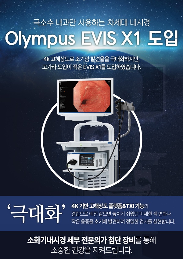 Olympus EVIS X1 내시경 장비 도입 공지